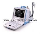 DP-3300全數字B超診斷儀