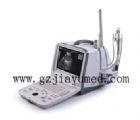 DP-6600全數字B超診斷儀